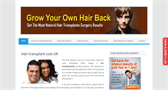 Desktop Screenshot of hairtransplant-guide.com
