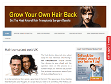 Tablet Screenshot of hairtransplant-guide.com